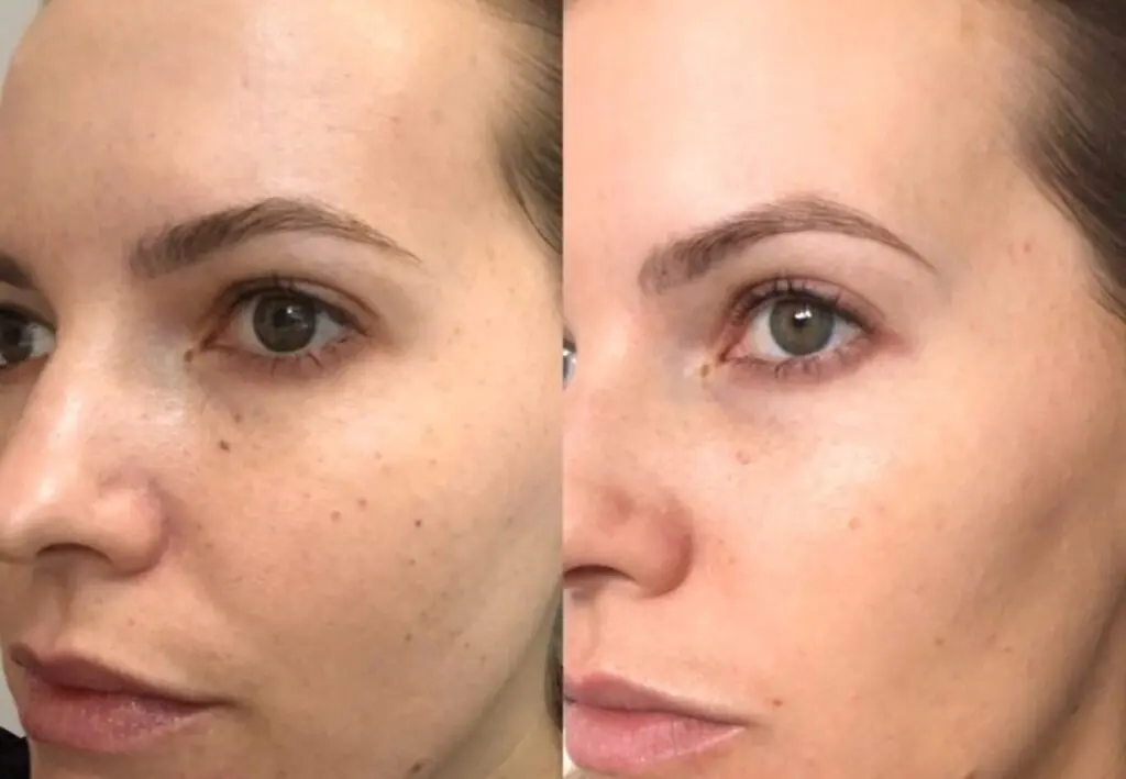 النضارة والتفتيح